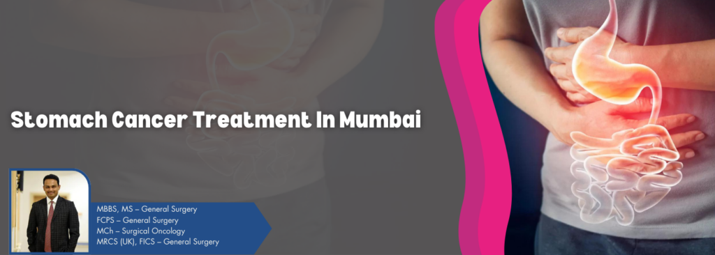 Stomach-cancer-treatment-banner