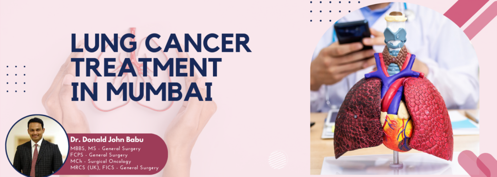 Lung Cancer Treatment Banner