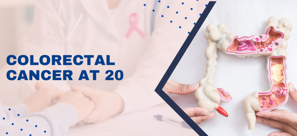 Colorectal_cancer_at_20