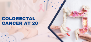 Colorectal Cancer at 20: Battling Early Onset