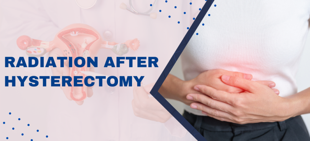 Radiation_after_Hysterectomy