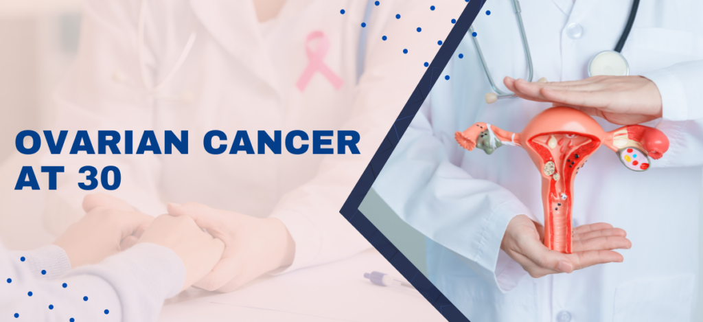 ovarian_cancer_at_30
