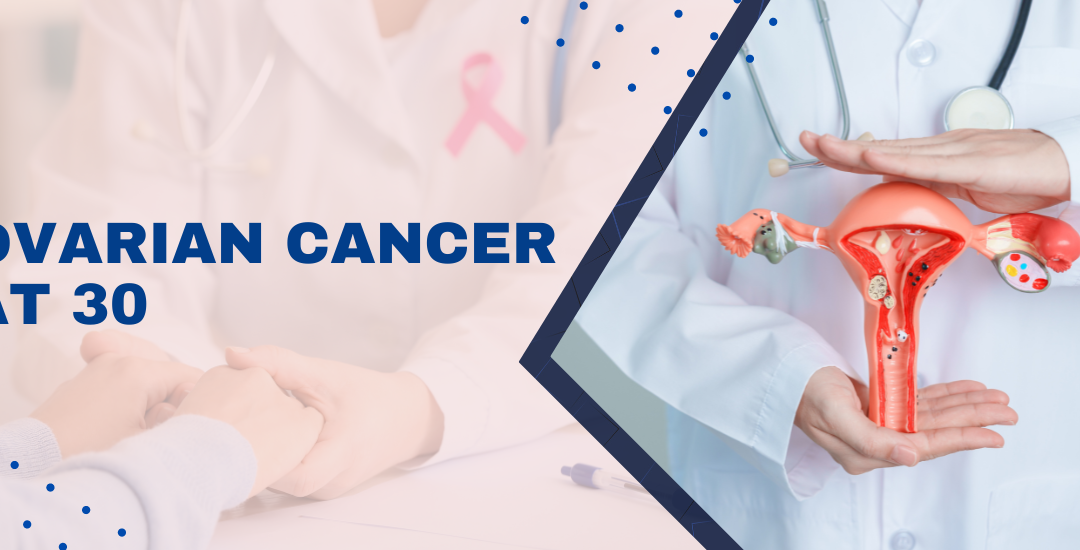 Ovarian Cancer at 30